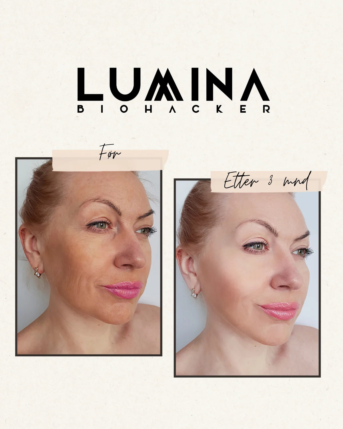 LUMINA Opti-Red LED-maske